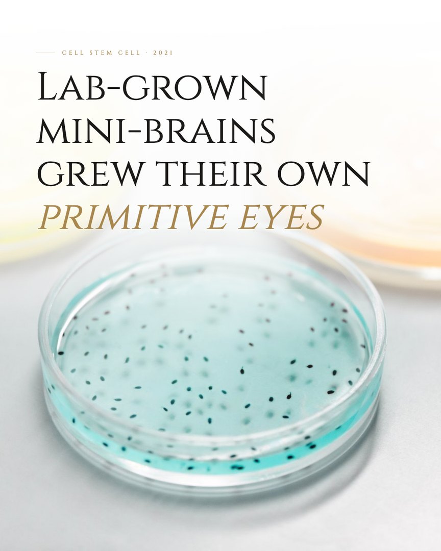 Crescent Discovery Series cover: Lab-grown mini-brains grew their own primitive eyes