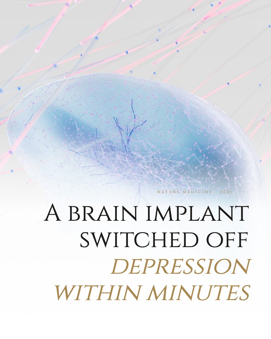 Crescent Discovery Series cover: A brain implant switched off depression within minutes