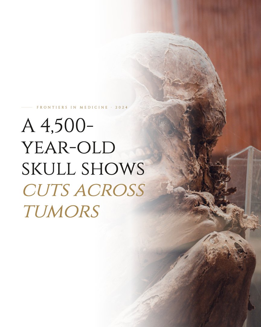Crescent Discovery Series cover: A 4,500-year-old skull shows cuts across tumors