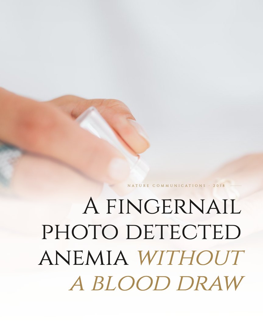 Crescent Discovery Series cover: A fingernail photo detected anemia without a blood draw