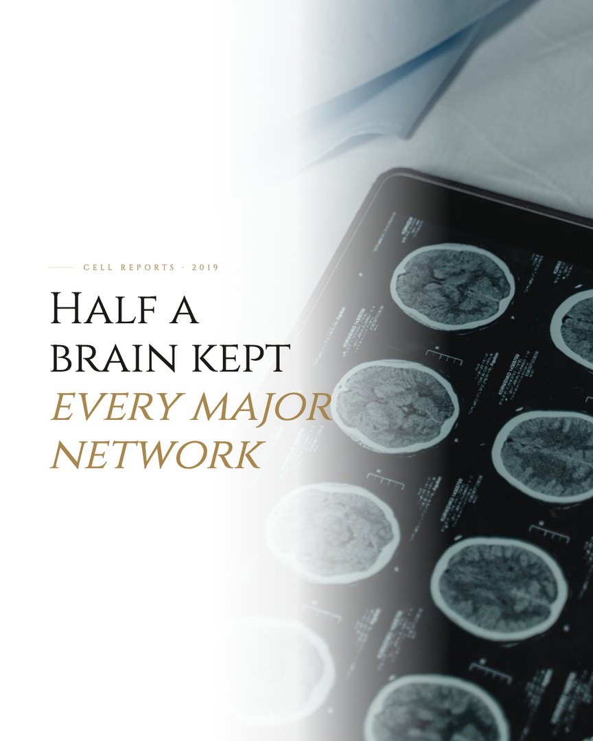 Crescent Discovery Series cover: Half a brain kept every major network