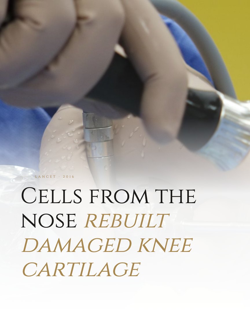 Crescent Discovery Series cover: Cells from the nose rebuilt damaged knee cartilage