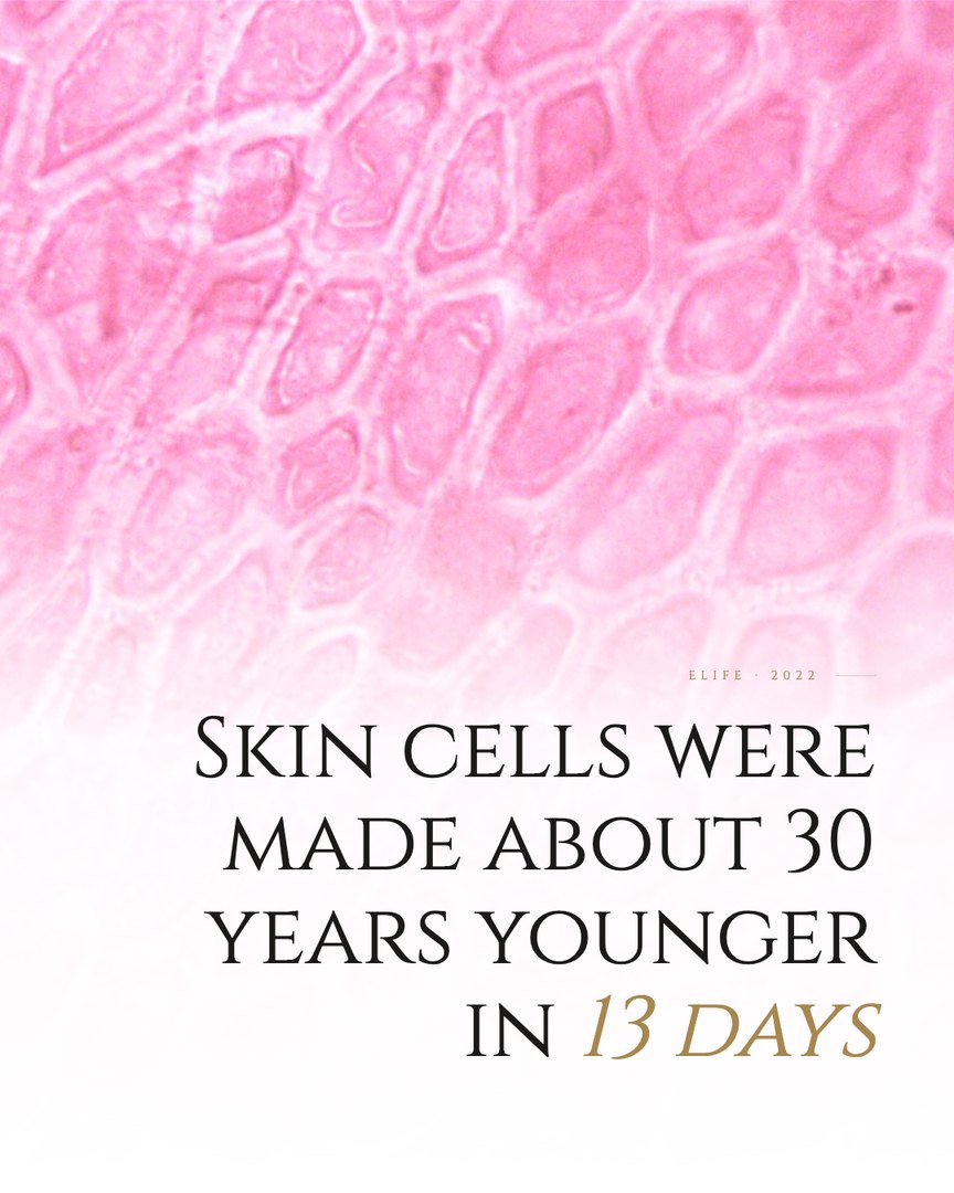 Crescent Discovery Series cover: Skin cells were made about 30 years younger in 13 days