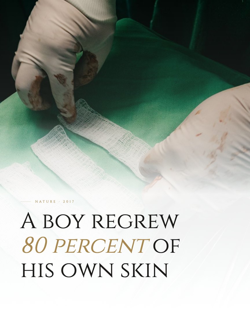 Crescent Discovery Series cover: A boy regrew 80 percent of his own skin
