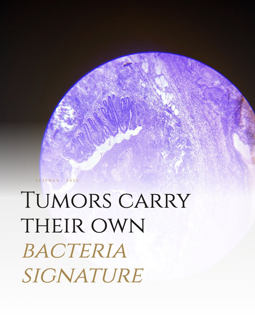 Crescent Discovery Series cover: Tumors carry their own bacteria signature