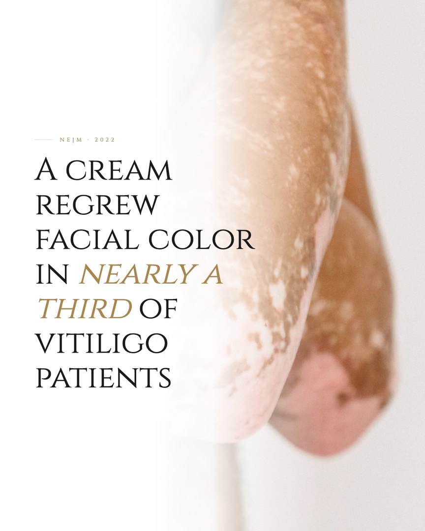 Crescent Discovery Series cover: A cream regrew facial color in nearly a third of vitiligo patients