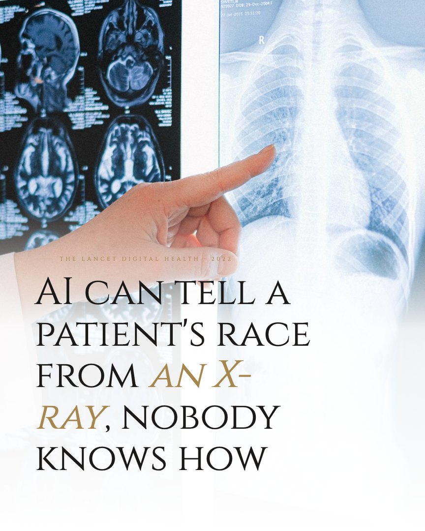 Crescent Discovery Series cover: AI can tell a patient's race from an X-ray, nobody knows how